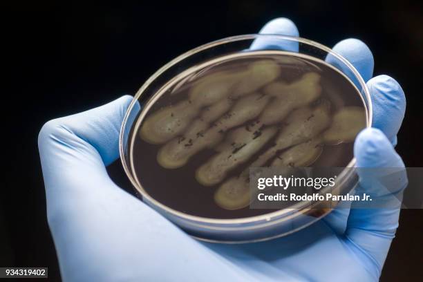 campylobacter bacteria - diarrhoea foto e immagini stock