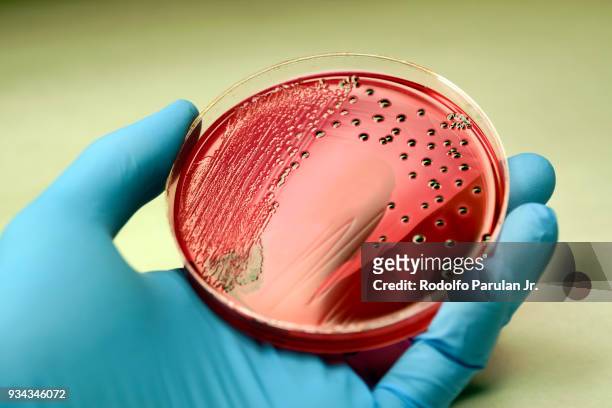 salmonella colonies growing on xld agar plate - salmonella bacterium - fotografias e filmes do acervo