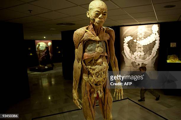 View of a human body part of the "Bodies...The Exhibition" at the Exhibition and Congress Palace in Granada, southern Spain, on November 27, 2009....