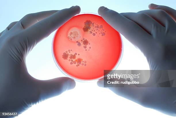 researcher holding blood agar plate - agar jelly stock pictures, royalty-free photos & images