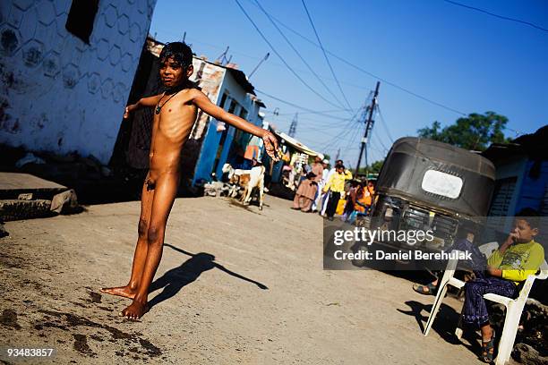 Nawab Mian, who suffers from mental illness related to the 1984 Bhopal gas disaster, stretches after receiving his daily bath, near the site of the...