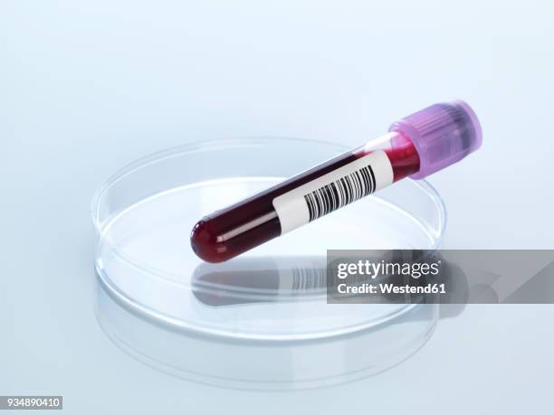 blood sample in petri dish - test tube stock pictures, royalty-free photos & images