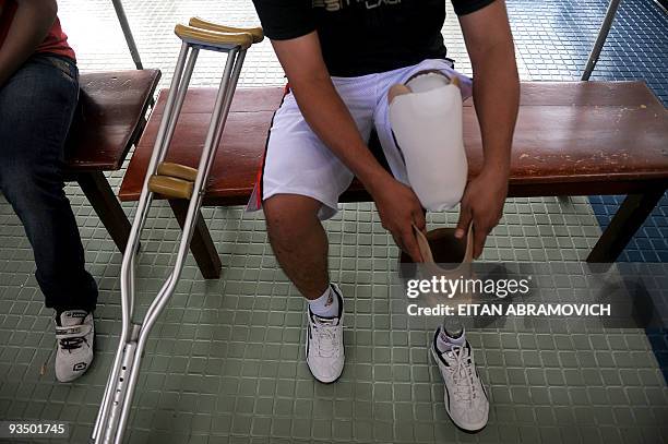 Serbio Tulio Cordoba Samaniego, victim of a landmine explosion, puts on his prosthesis at the Colombian Centre for Integrated Rehabilitacion in...