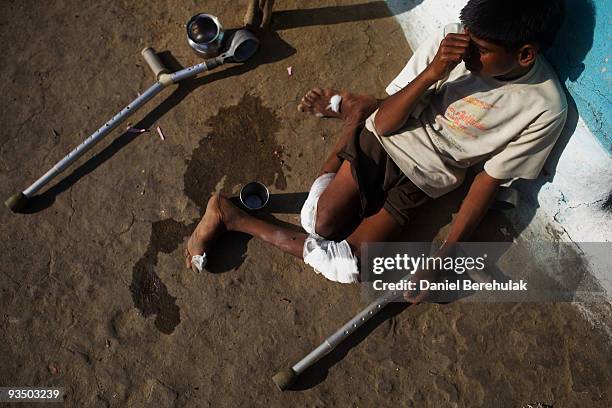 Fifteen year old Sachin Kumar suns himself outside his home in a slum near the site of the deserted Union Carbide factory on November 30, 2009 in...