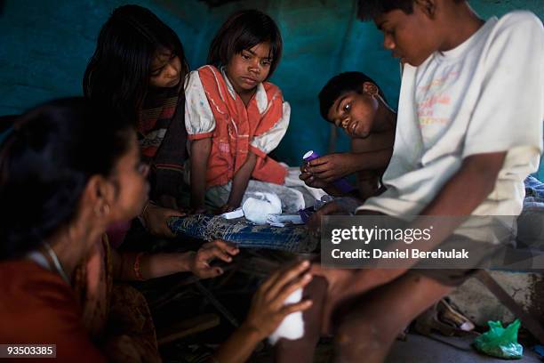 Sister Jyoti , brother Ravi watches as their brother Fifteen year old Sachin Kumar has antiseptic cream applied to his open sores by their mother...