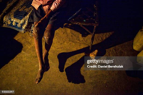 Fifteen year old Sachin Kumar sits on his bed waiting for his dinner in a slum near the site of the deserted Union Carbide factory on November 29,...