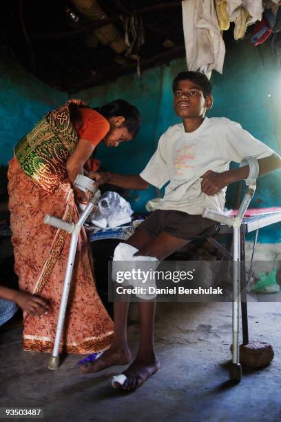 Fifteen year old Sachin Kumar attempts to walk with the assistance of crutches in his home located in a slum near the site of the deserted Union...