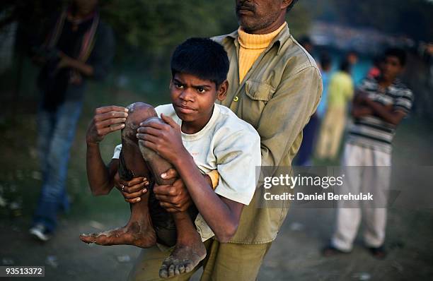Year old Sachin Kumar is carried back to his home after playing cricket with his friends in a slum near the site of the deserted Union Carbide...