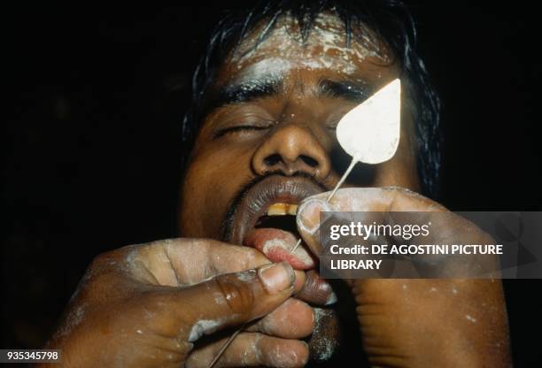 Penitent having his cheeks and tongue pierced with a pin by a priest during the feast of the God Skanda, Kataragama, Sri lanka.