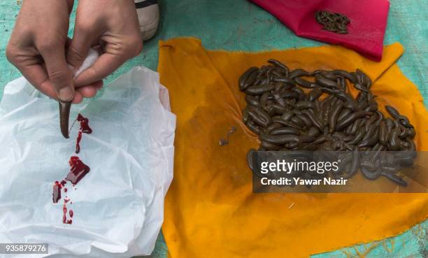 Practitioner releases the blood from a leech which it sucked from a patient, after a leech therapy, on March 21 in Srinagar, the summer capital of...