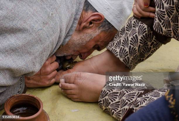 An elderly Kashmiri Muslim practitioner blows hot air from his mouth on the leeches, as he gives leech therapy to a patient, on March 21 in Srinagar,...