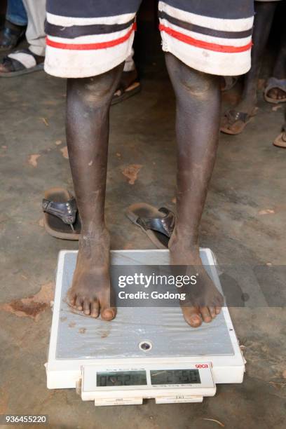 Kiryangondo refugee camp. Malnutrition prevention program run by Concern worldwide. Uganda.