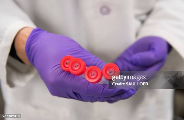 Dr. Benjamin Jin, a biologist working on immunotherapy for HPV+ cancers, holds test tubes as he works in the lab of Dr. Christian Hinrichs, an...