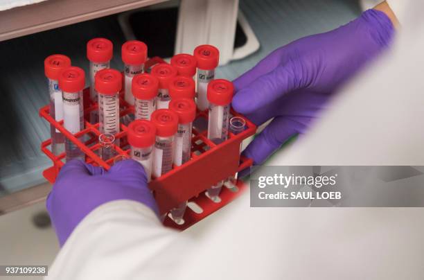 Dr. Benjamin Jin, a biologist working on immunotherapy for HPV+ cancers, holds test tubes as he works in the lab of Dr. Christian Hinrichs, an...