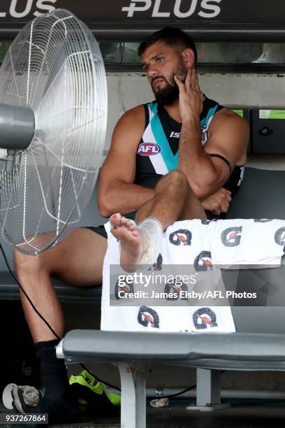 Injured Paddy Ryder of the Power on the bench during the 2018 AFL round 01 match between the Port Adelaide Power and the Fremantle Dockers at...