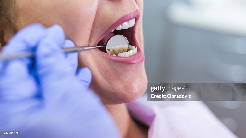 Open female mouth during oral checkup at the dentist. Selective