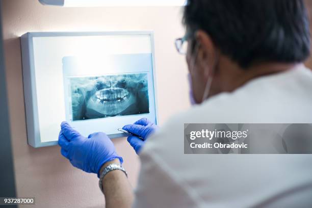radiografia dentale - extraction forceps foto e immagini stock
