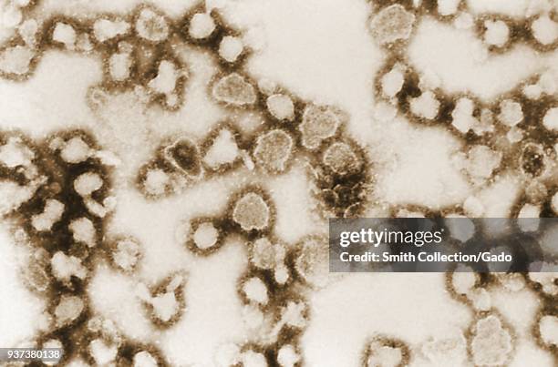 La Cross virus , Arboviral pathogen, member of the Bunyaviridae virus family, revealed in the photomicrograph film, 1981. Image courtesy Centers for...