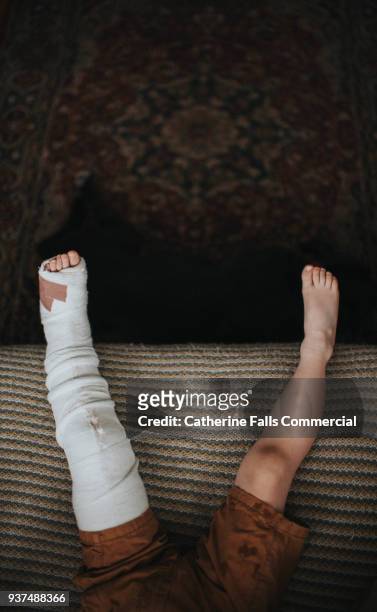 broken leg - femur fotografías e imágenes de stock