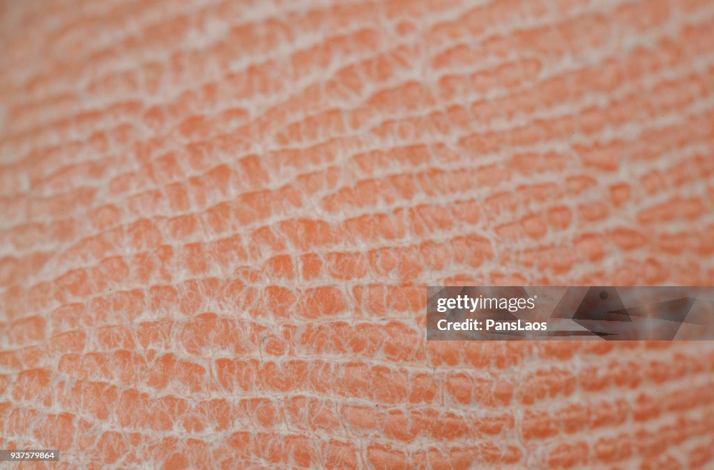 Macro of dry human skin