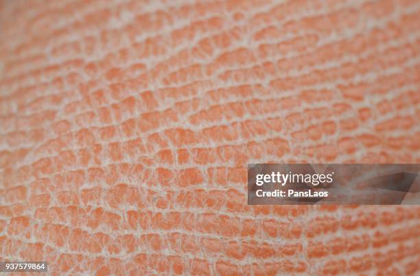 macro of dry human skin - dry skin - fotografias e filmes do acervo