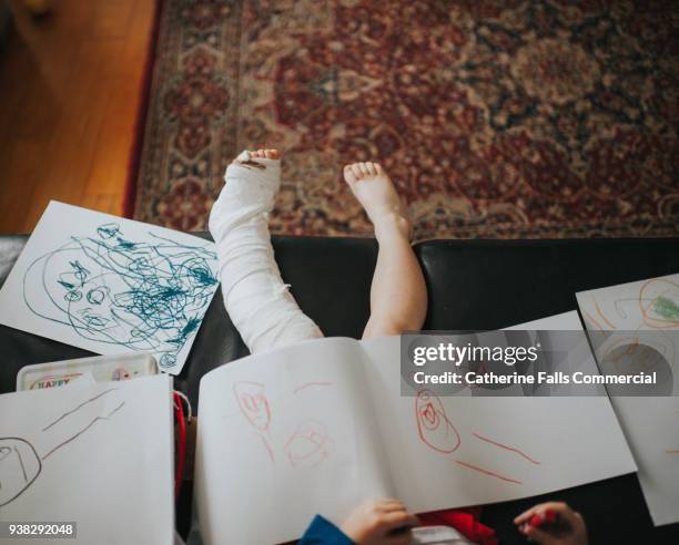 child with broken leg - gips bouwmateriaal stockfoto's en -beelden