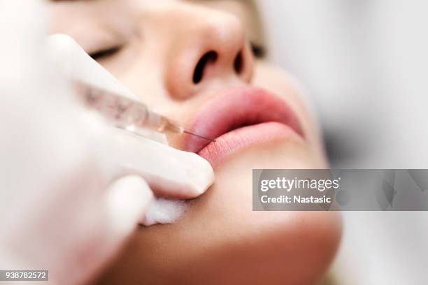 cosmetóloga profesional inyectando silicona en labios - beauty treatment fotografías e imágenes de stock