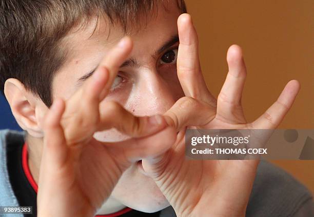 Disabled and orphaned Romanian adult gestures at the Babeni orphanage, southwestern Romania on November 26, 2009. Twenty years after the death of...