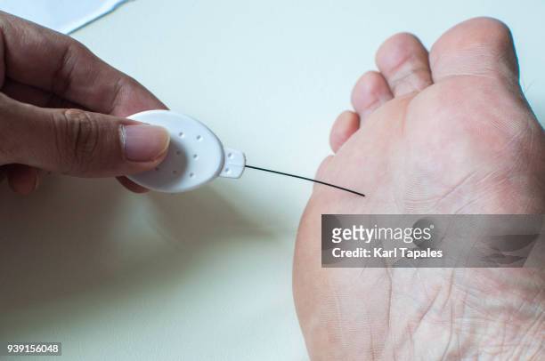 diabetic foot neuropathy filament test - diabetes feet stock pictures, royalty-free photos & images