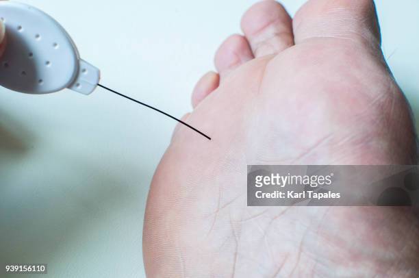 diabetic foot neuropathy filament test - diabetic foot care stock pictures, royalty-free photos & images