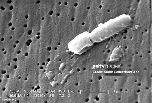Ultrastructural morphologic features of a Klebsiella pneumoniae bacterium revealed in the scanning electron microscopic image, 2005. Image courtesy...