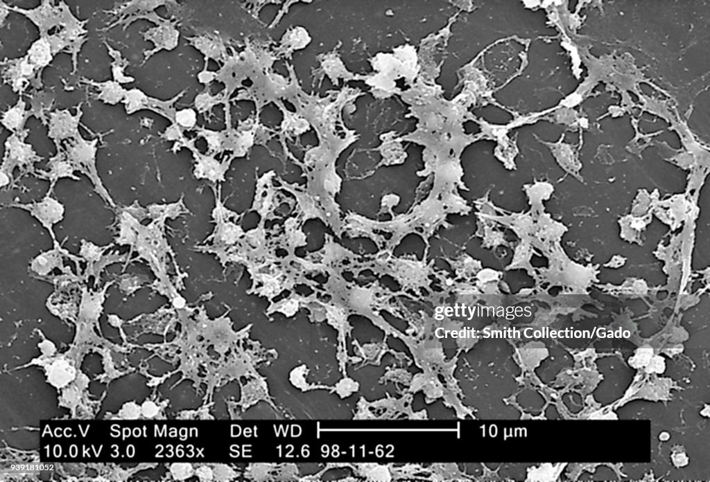 Staphylococcus Bacteria