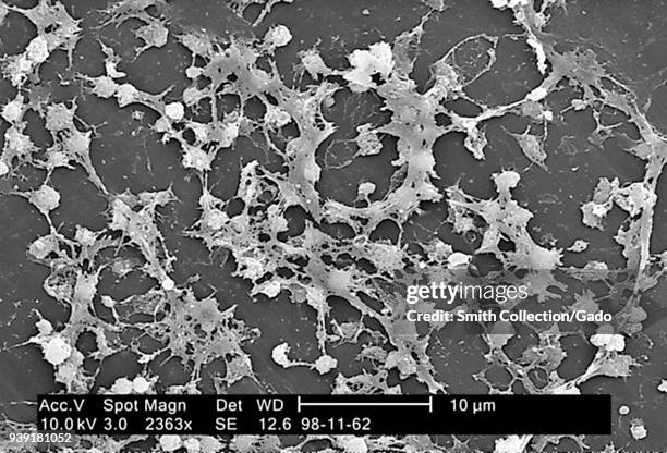 Staphylococcus aureus bacteria inside the lumen of an indwelling catheter revealed in the electron micrograph image, 2005. Image courtesy Centers for...