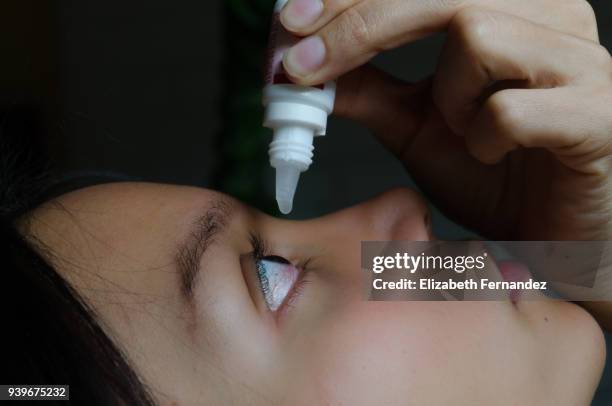 woman applying eye-drops into her eye - eyedropper bildbanksfoton och bilder