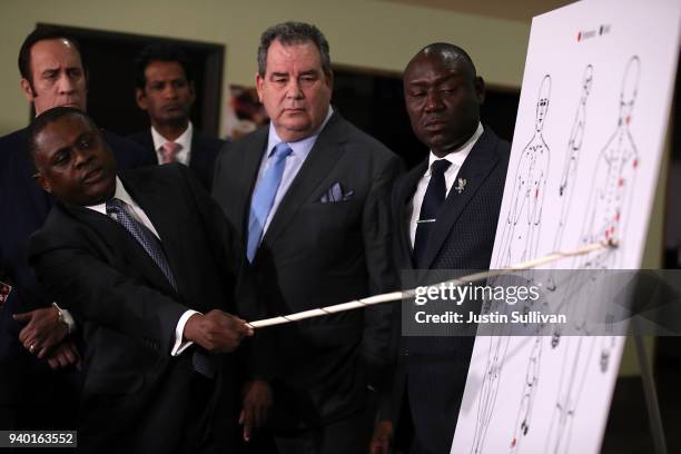 Dr. Bennet Omalu points to a chart as he discusses results of his autopsy of Stephon Clark as attorneys Brian Panish and Ben Crump look on during a...