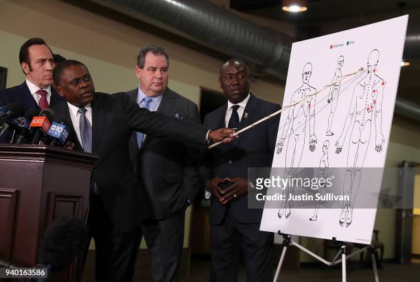Attorney Dale Galipo, Dr. Bennet Omalu, attorney Brian Panish and attorney Ben Crump examine a picture showing gunshot wounds to Stephon Clark during...