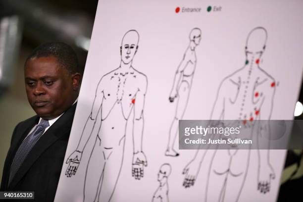 Dr. Bennet Omalu stands by a diagram showing the results of his autopsy of Stephon Clark during a news conference at the Southside Christian Center...