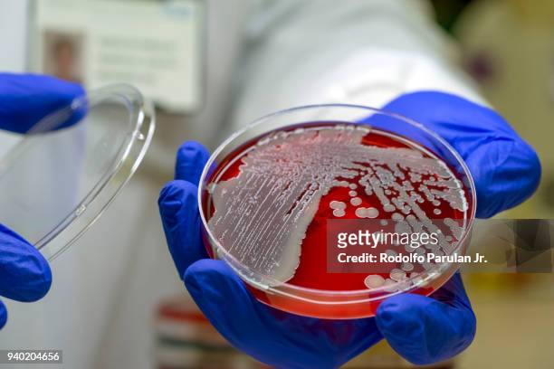 microbiologist examining an mrsa bacteria on blood agar plate - メチシリン耐性黄色ブドウ球菌 ストックフォトと画像