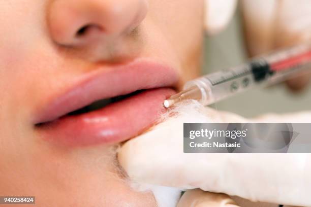 esthéticienne professionnelle par injection de silicone dans les lèvres - human lips stock photos et images de collection