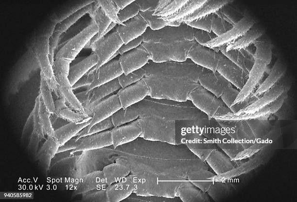 Trunk region leg segments of an unidentified millipede found in Decatur, Georgia, revealed in the 12x magnified scanning electron microscopic image,...