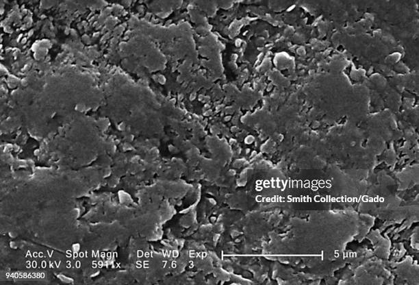 Rough surface of a Vitis specimen white table grape revealed in the 5911x magnified scanning electron microscopic image, 2005. Image courtesy Centers...