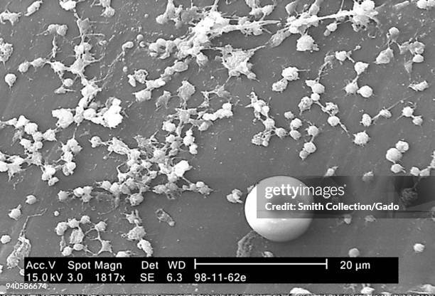 Staphylococcus aureus bacteria on the luminal surface of an indwelling catheter revealed in the electron micrograph image, 2005. Image courtesy...