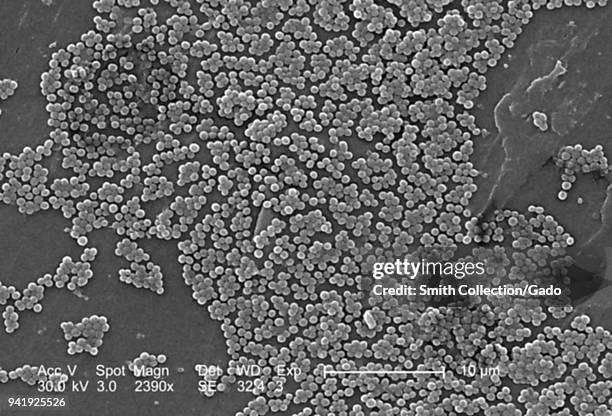 Clumps of methicillin-resistant Staphylococcus aureus bacteria revealed in the 2390x magnified scanning electron microscopic image, 2005. Image...