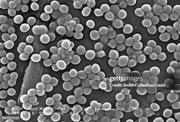 Clumps of methicillin-resistant Staphylococcus aureus bacteria revealed in the 9560x magnified scanning electron microscopic image, 2005. Image...