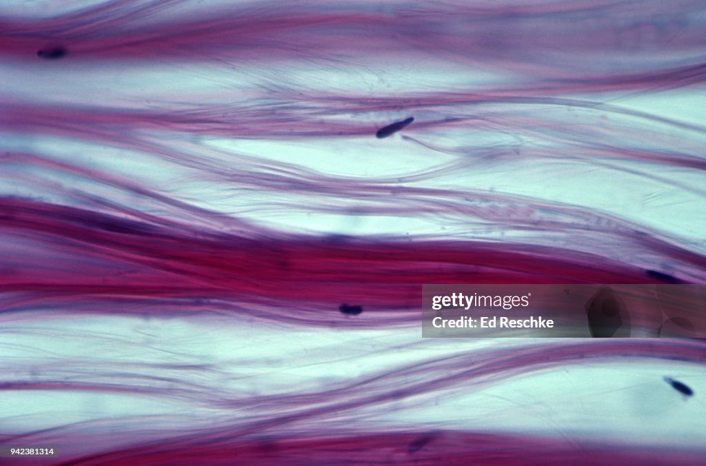 DENSE FIBROUS REGULAR CONNECTIVE TISSUE--TENDON--Teased to show Collagenous Fibers and Fibroblasts, 250X