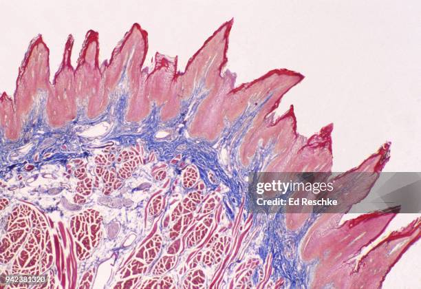 papillae on the human tongue, 5x - epitélio escamoso imagens e fotografias de stock