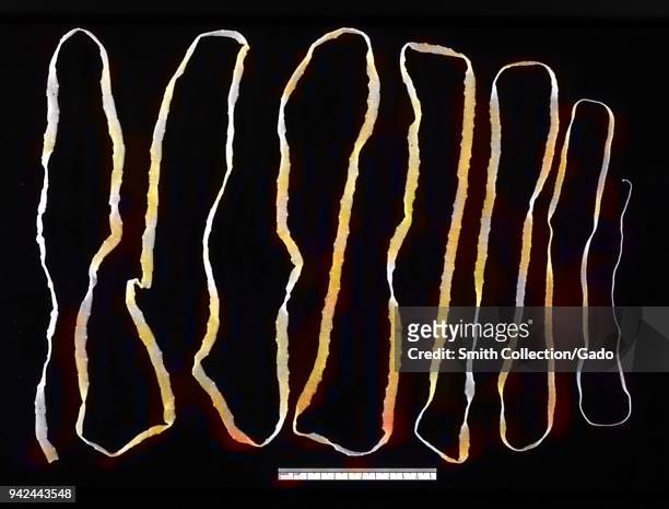Adult tapeworm in the human intestine, 1986. Image courtesy Centers for Disease Control . Note: Image has been digitally colorized using a modern...