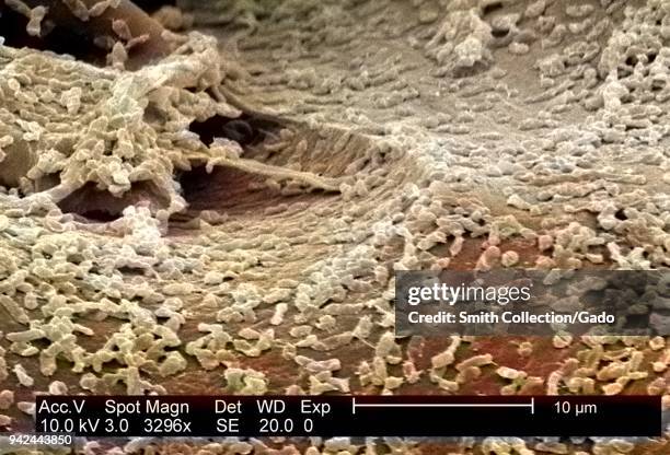 Micrograph of a colony of the Gram-Negative bacteria P mirabilis cultivated on a polycarbonate surface using a CDC biofilm reactor, 2003. Image...