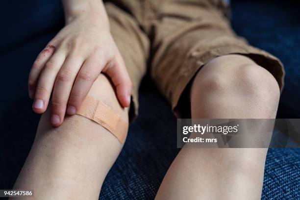 bruised knee - pflaster stock-fotos und bilder