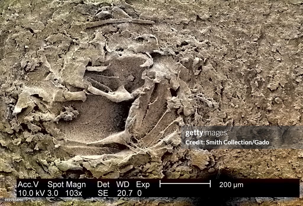 24Hr Biofilm Of P. Mirabilis (Colorized)